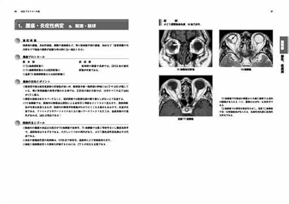 MRIプロトコール集 | 櫛橋 民生 |本 | 通販 | Amazon