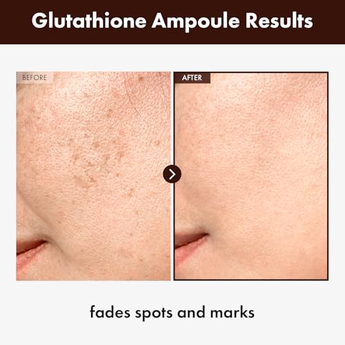TOSOWOONG Glutathione Serum with 20,000ppm Glutathione, Niacinamide and hyaluronic acid, Improve skin elasticity, Revitalize complexion, Korean Skincare, 30ml, 1.01 fl. oz. - Image 3