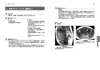 MRIプロトコール集 櫛橋 民生 Amazon.co.jp: MRIプロトコール集 : 櫛橋 民生: Japanese Books