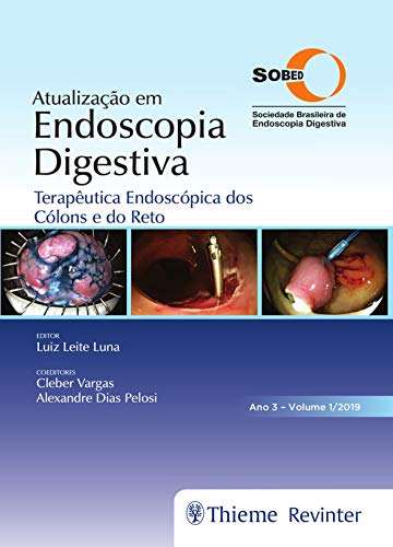 SOBED Atualização em Endoscopia Digestiva: Terapêutica Endoscópica dos Cólons e do Reto