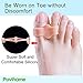 Povihome 10 Pack Big Toe Separators, Temporary Bunion Corrector (1st/2nd Toe), Silicone Toe Spacers for Bunion Pain Relief, Overlapping Toe - Beige
