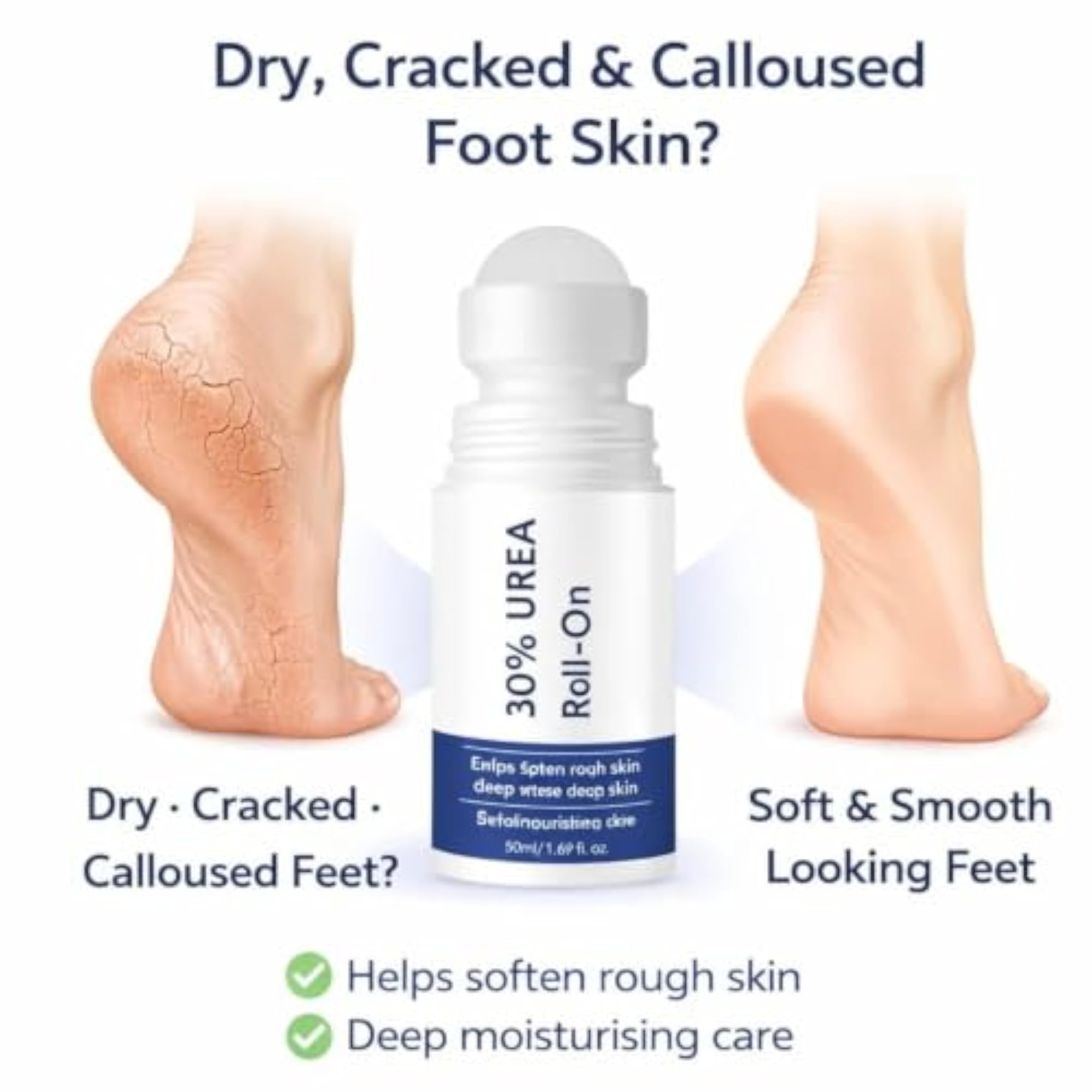 AGE18'S Urea Foot Cream Roll On for Cracked Heels, Deep Moisturizing