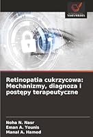 Retinopatia cukrzycowa: Mechanizmy, diagnoza i postepy terapeutyczne (Polish Edition) 6208478936 Book Cover