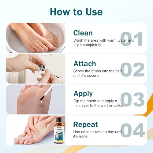 Image of TAG WART Remover, Freeze Off Liquid with 17% Salicylic Acid - Fast-Acting Freeze Off Treatment for Common & Plantar Warts,Flat Wart, Corns - for Feet, Hands & Body (1oz)