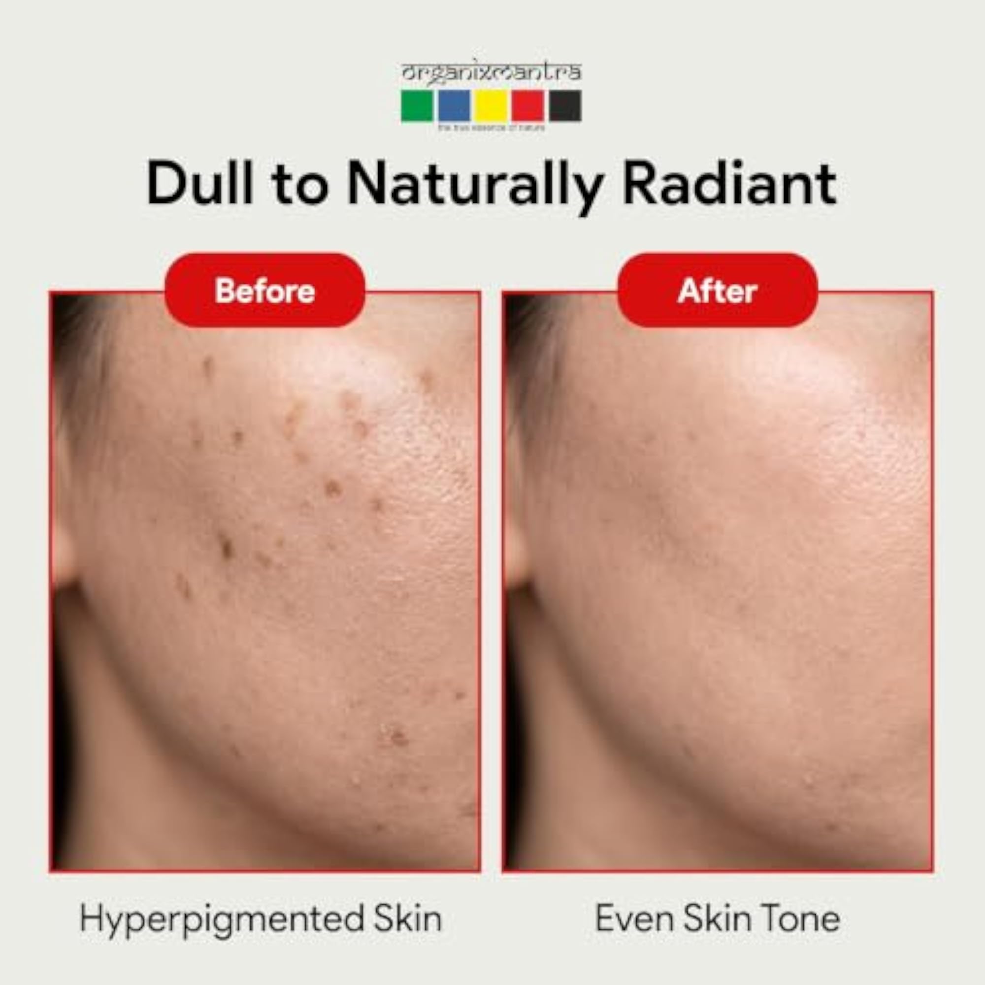 Rosehip Seed Body Oil for Face Wrinkles, Fine Lines, 30ML