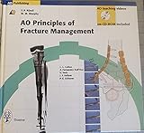 Ao Principles of Fracture Management