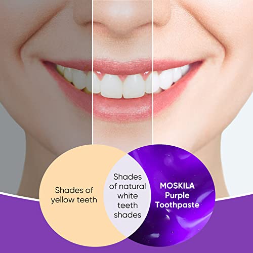 Purple Toothpaste For Teeth Whitening, Purple Toothpaste, Tooth Stain Removal And Teeth Whitener #TOP1