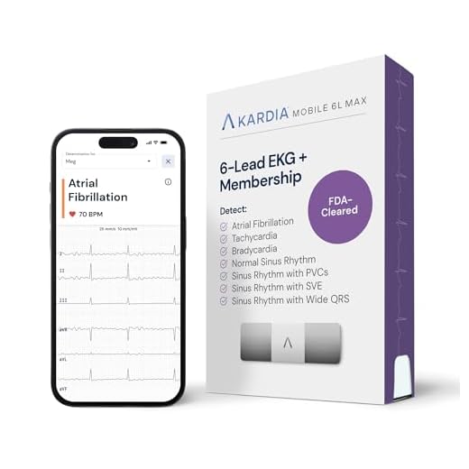 KardiaMobile Personal EKG Heart Rate Monitor – 6 Leads - Record EKGs at Home - Detect Irregular Heartbeats and Irregular Arrhythmias - Includes 1 Year Access - Works with Most Smartphones – AliveCor