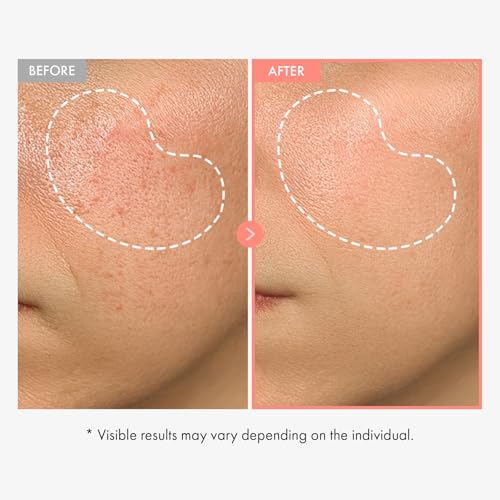 Image of TOSOWOONG Peach 80 Niacin Serum for Dark Spots & Pores, Glass Skin, Glow