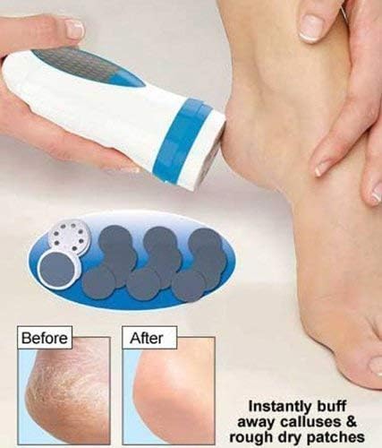 ShopoBox Pedi Spin Professional Callus Dead and Dry Skin Remover