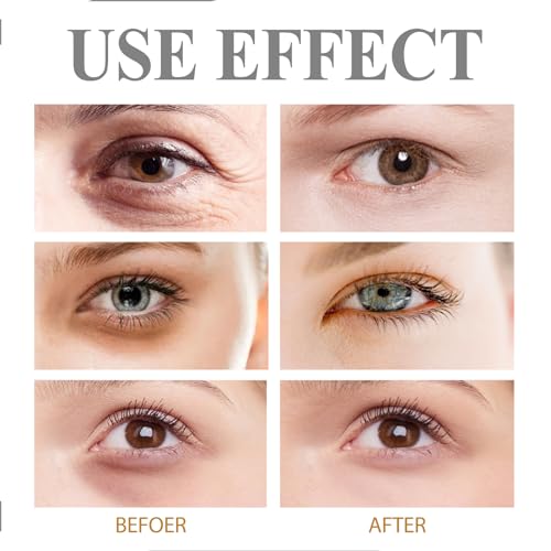 Instant Eye Tightener, Eye Cream For Dark Circles and Puffy Eyes, Anti Wrinkle Eye Cream with Retinol And Collagen, Firming Eye Cream for Fade Dark Circles Under the Eye and Moisturize Skin - Image 6