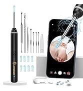 Amazon.co.jp: VITCOCO 耳かきカメラ みみかき イヤースコープ 極細