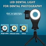 Zoom IMG-1 ngary luce fotografica dentale mobile Zoom IMG-1 ngary luce fotografica dentale mobile