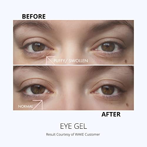 Wake huidverzorging – Ooggel – Hydraterende oogserum voor gezwollen ogen, donkere kringen, wallen, kraaienpootjes en… - Afbeelding 5