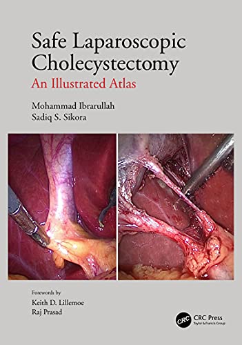 Safe Laparoscopic Cholecystectomy: An Illustrated Atlas #TOP8
