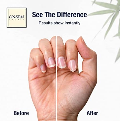 Onsen Cuticle Cream, Cuticle Oil in Deep Action - Japanese Natural Healing Minerals Nail Care Serum and Butter, Sooth, Repair, and Strengthen Cuticles and Nails, Visible Results, Non-Greasy - 30ml