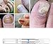2 Pcs Advanced Nail Natural Repair Magic Pen Anti Nail Treatment Stop Nail Gel