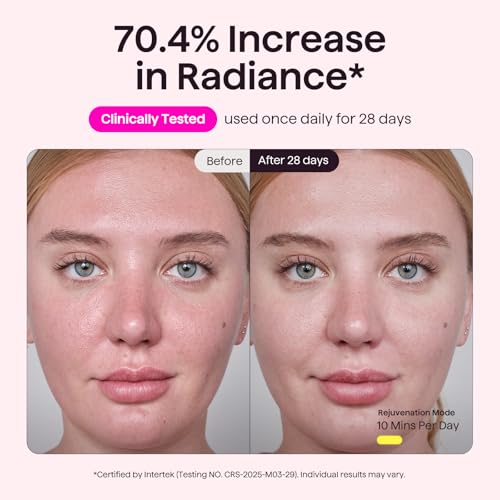 Image of Wavytalk Red Light Therapy Mask for Face, Glow Time LED Face Mask Light Therapy for Anti-Fine Line, Acne, Skin Rejuvenation with Red, Near-Infrared Light, Blue and Amber Light Therapy (White)