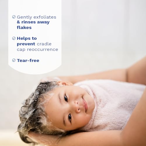 Image of Mustela Cradle Cap Foam Shampoo for Newborn - Baby Shampoo with Natural Avocado - Tear-Free & Fragrance-Free - 150ml