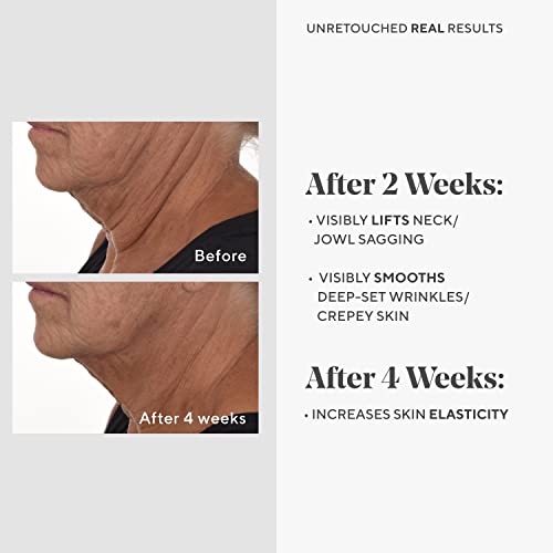 Murad Retinal Resculpt Overnight Treatment - Resurgence Anti-Aging Serum For Lines And Wrinkles – Encapsulated Vitamin A Skin Care For Smoothing, Firming And Lifting Face And Neck, 1.0 Fl Oz #TOP3