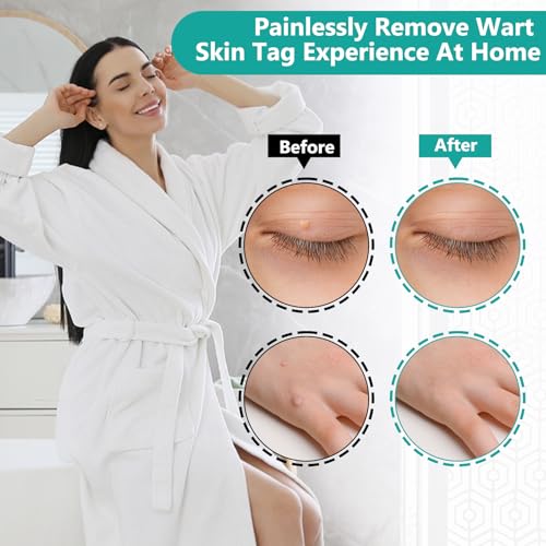 Kit de retrait indolore pour peau pour une routine beauté sans complexe - 7