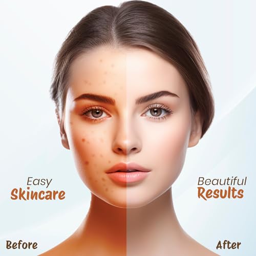 Image of Nisha sandal Multani Mitti for Face 100g | Fuller's Earth Powder | Natural Oil Control, Acne & Tan Removal | Skin Brightening Face Pack
