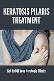  Keratosis Pilaris Treatment: Get Rid Of Your Keratosis Pilaris: Keratosis Pilaris Treatment Cream (English Edition)