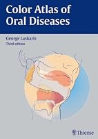 Color Atlas of Oral Diseases 3137170028 Book Cover