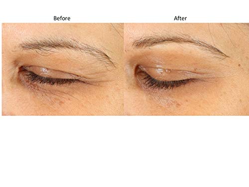 Miniatura 5 de Bluelene EyePlus+, una nueva fórmula impulsada por la trifecta definitiva de azul de metileno, ergotioneína y niacinamida. Aprobado por