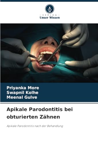 Apikale Parodontitis bei obturierten Zähnen: Apikale Parodontitis nach der Behandlung ...