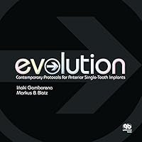 Evolution: Contemporary Protocols for Anterior Single-Tooth Implants 0867154969 Book Cover