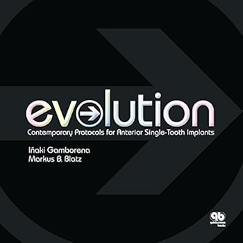 Hardcover Evolution: Contemporary Protocols for Anterior Single-Tooth Implants Book