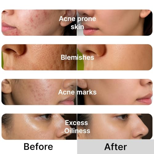 Image of Niacinamide Capsule Cream 100g | 10% Niacinamide, TXA & Alpha Arbutin | Brightening Cream for Dark Spots, Pigmentation & Uneven Skin Tone