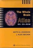 The Whole Brain Atlas on Cd-rom (For Windows & Macintosh)