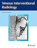 Venous Interventional Radiology (English Edition)