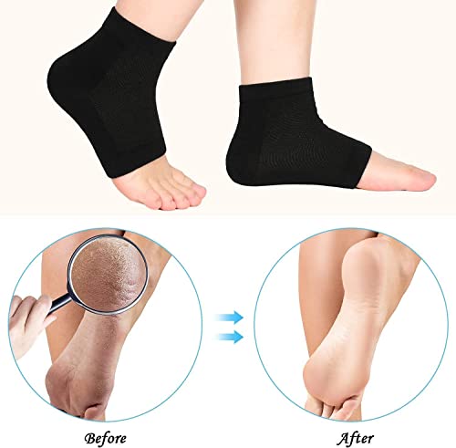 3 Pairs Moisturizing Socks,Soft Ventilate Gel Heel Socks Open Toe Socks For Dry Hard Cracked Skin Moisturizing Day Night Care Skin (Black, One Size) #TOP4