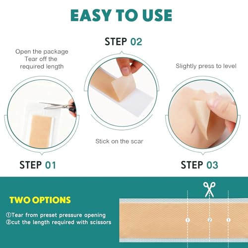 Image of Silicone Scar Sheets, Silicone Scar Tape(5.7 inch x 1.57 inch 10 Pcs), Scar Removal Away Strips for Surgical Scars, Keloid, C-Section, Burn et
