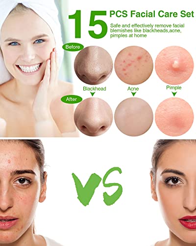 15 Pcs Blackhead Remover Pimple Popper Tool Kit,Black Head Removal Extractor For Acne Comedone Whitehead Popping Zit Blemish Facial Skin Care Tools With Metal Case #TOP1