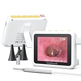 ScopeAround Otoscope with Light, 3.9mm Ultra-Thin HD Smart Visual Ear Camera, Digital Otoscope for Kids and Adults, Plug & Play Ear Wax Removal Tool Camera for Home Ear Inspection(White)