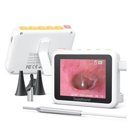 ScopeAround Otoscope Ear Camera, 3.9mm Otoscope with Light 720P HD Ear Scope,Digital Otoscope with 6 LED Lights for Kids and Adults