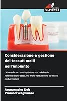 Considerazione e gestione dei tessuti molli nell'impianto (Italian Edition) 6208464919 Book Cover