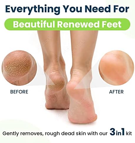EXTRA STRENGTH Callus Remover Gel For Feet - Made In USA, Professional Foot Scrubber To Remove Calluses and Dead Skin on Heel, Exfoliator and Softener, Pedicure Supplies Fix Dry Cracked Peeling Heels (2 Pack)