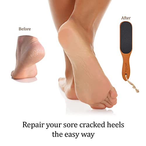 Pumice Stone Foot File - Wooden Pedicure Feet Scrubber With Handle For Callus, Dry, And Dead Skin Removal - Heel Scraper For Feet, Hands, And Body - Foot Filer For Use In Shower #TOP4