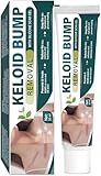 Keloid Bump Removal, Scar Removal for Surgical Marks & Burns, Gentle Effective Keloid Scar Treatment for Face and Body Healing