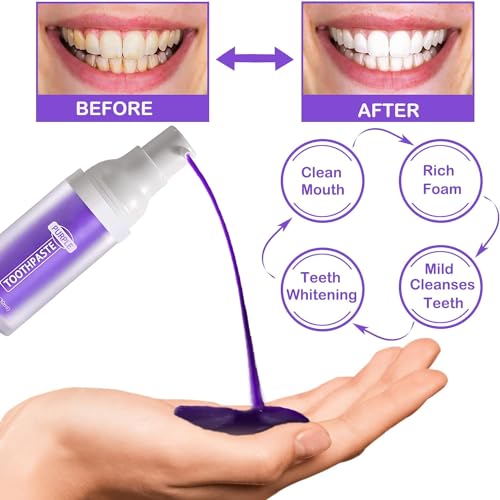 Purple Toothpaste For Teeth Whitening,lila zahnpasta weisse zähne,Lila Zahnpasta weiße zähne