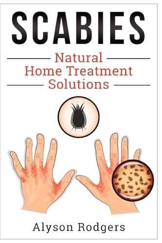 Scabies Natural Home Treatment Solution