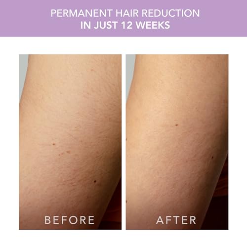 Foreo Peach 2 Go, Epilatore Luce Pulsata - Depilatore Corpo Donna I Uomo - Epilatore Viso Donna - Alternativa All' Epilatore Laser - Rapido E Indolore - Sistema Refrigerante - Lavender - 5