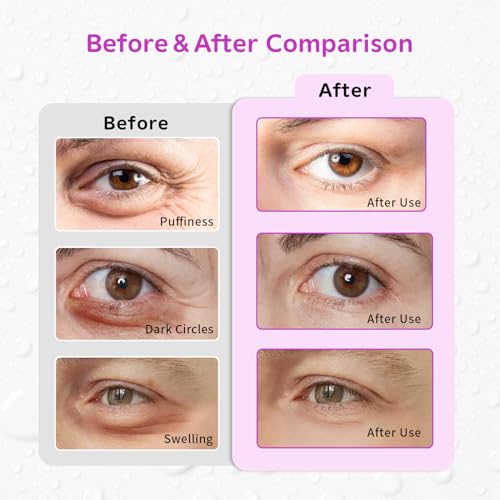 Image of 4PCS Gel Eye Ice Pack Set, Cold & Hot Compress, Reusable Cooling Gel Pads for Strain Relief, Relaxation, SPA and Sleep (4 Purple Flowers-2)