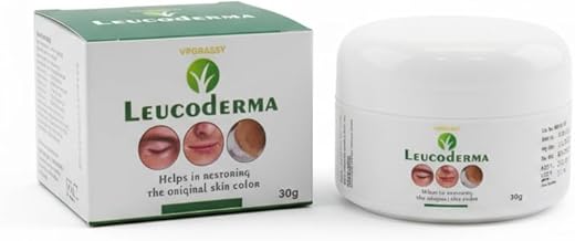VPGRASSY Leucoderma Cream - 30g Anti-White Spots Formula for Repigmentation & Skin Support (Vitiligo Management)