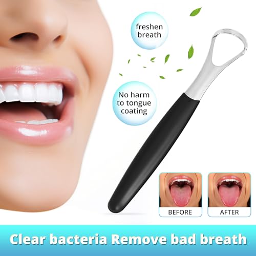 Image of Oral Care Dental Cleaning Kit, Dental Mirror with Light, Explorer Pick, and Tongue Scraper Quality Stainless Steel Dental Tools, Easy-Grip Handle (red mirror)
